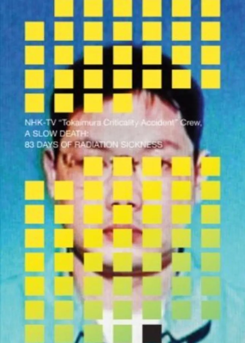 A Slow Death: 83 Days of Radiation Sickness